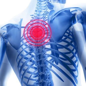 Chest pain with thoracic osteochondrosis