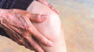 Osteoarthritis of the knee