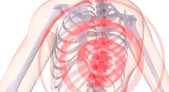 Pain in the spine with thoracic osteochondrosis