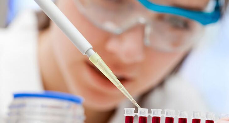 Blood tests for hip arthritis